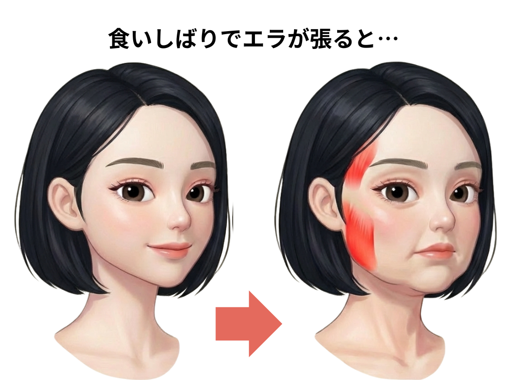 食いしばりによるエラ張りとたるみの女性の画像