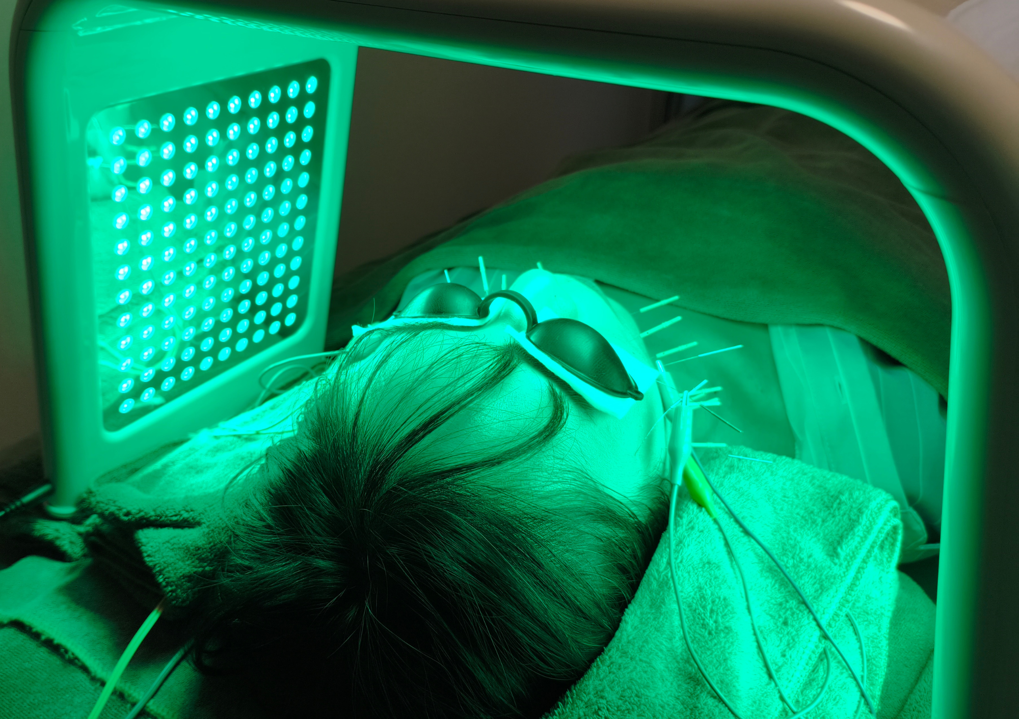亀戸にある鍼灸サロンやなけんの緑色LEDの施術