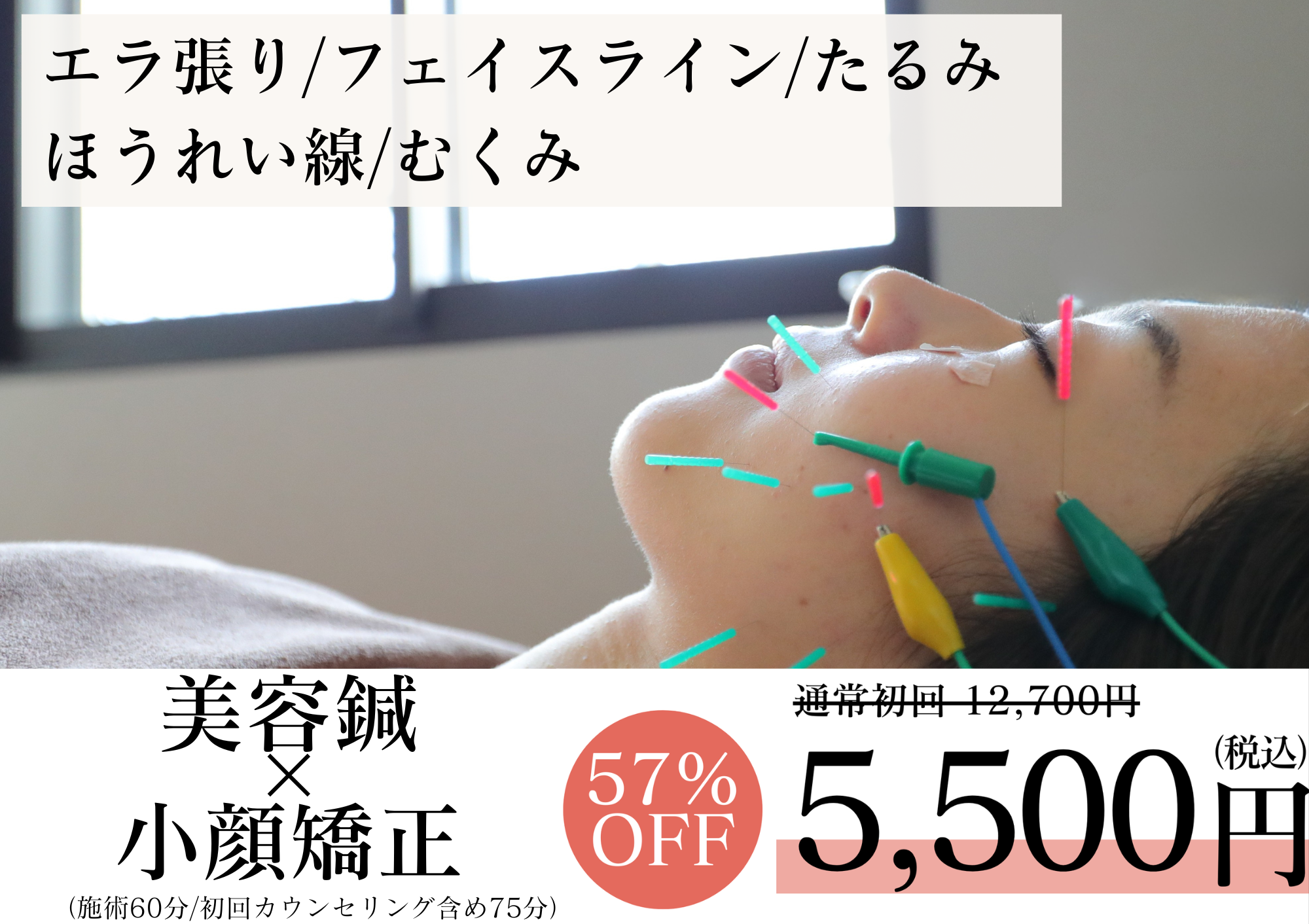 亀戸にある鍼灸サロンやなけんの美容鍼+小顔矯正初回限定価格のご案内
