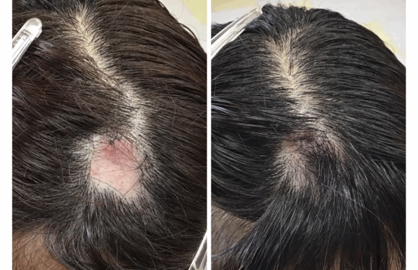 亀戸にある鍼灸サロンやなけんの育毛、強髪、薄毛