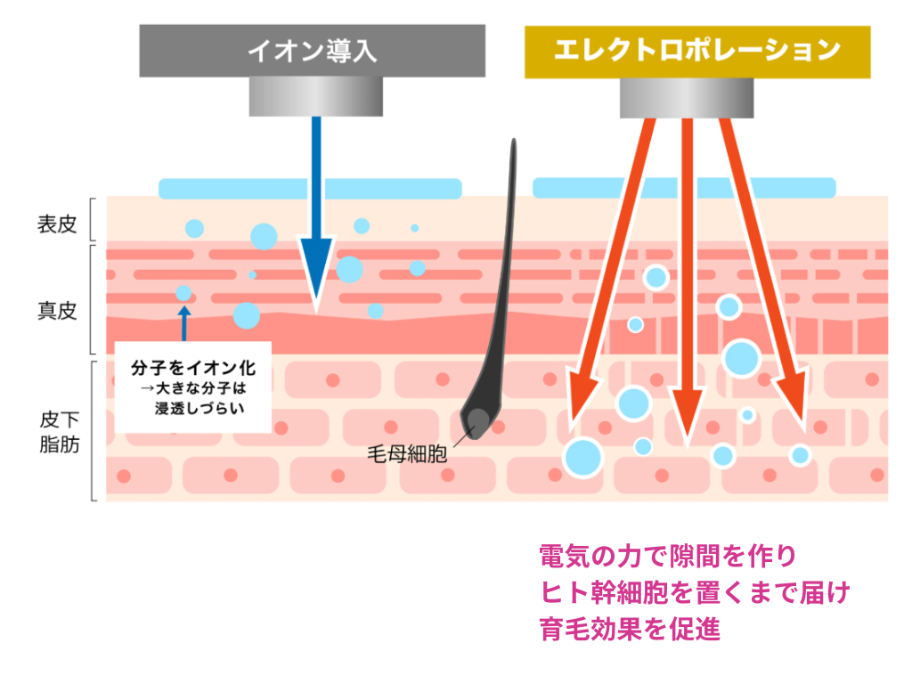 鍼灸サロンやなけん亀戸店のエレクトロポレーション