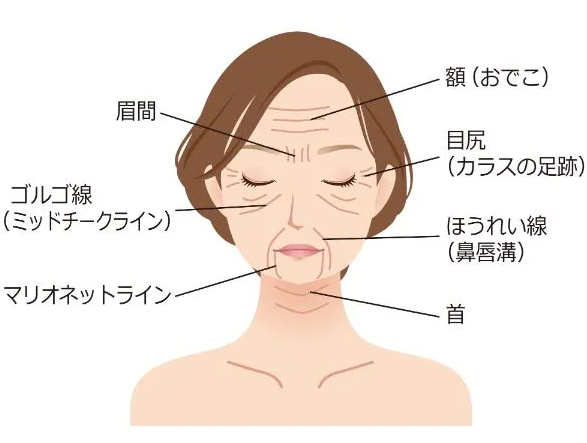 美容のお悩みのイメージ図