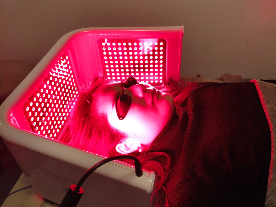 亀戸にある鍼灸サロンやなけんの薄毛に特化した育毛鍼