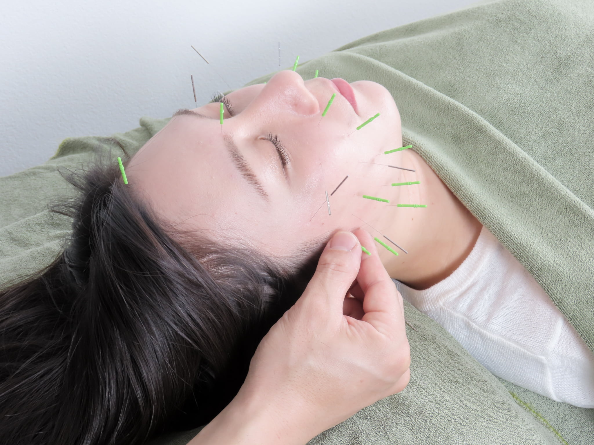 エラ張り、たるみ改善特化のやなけん亀戸店の美容鍼