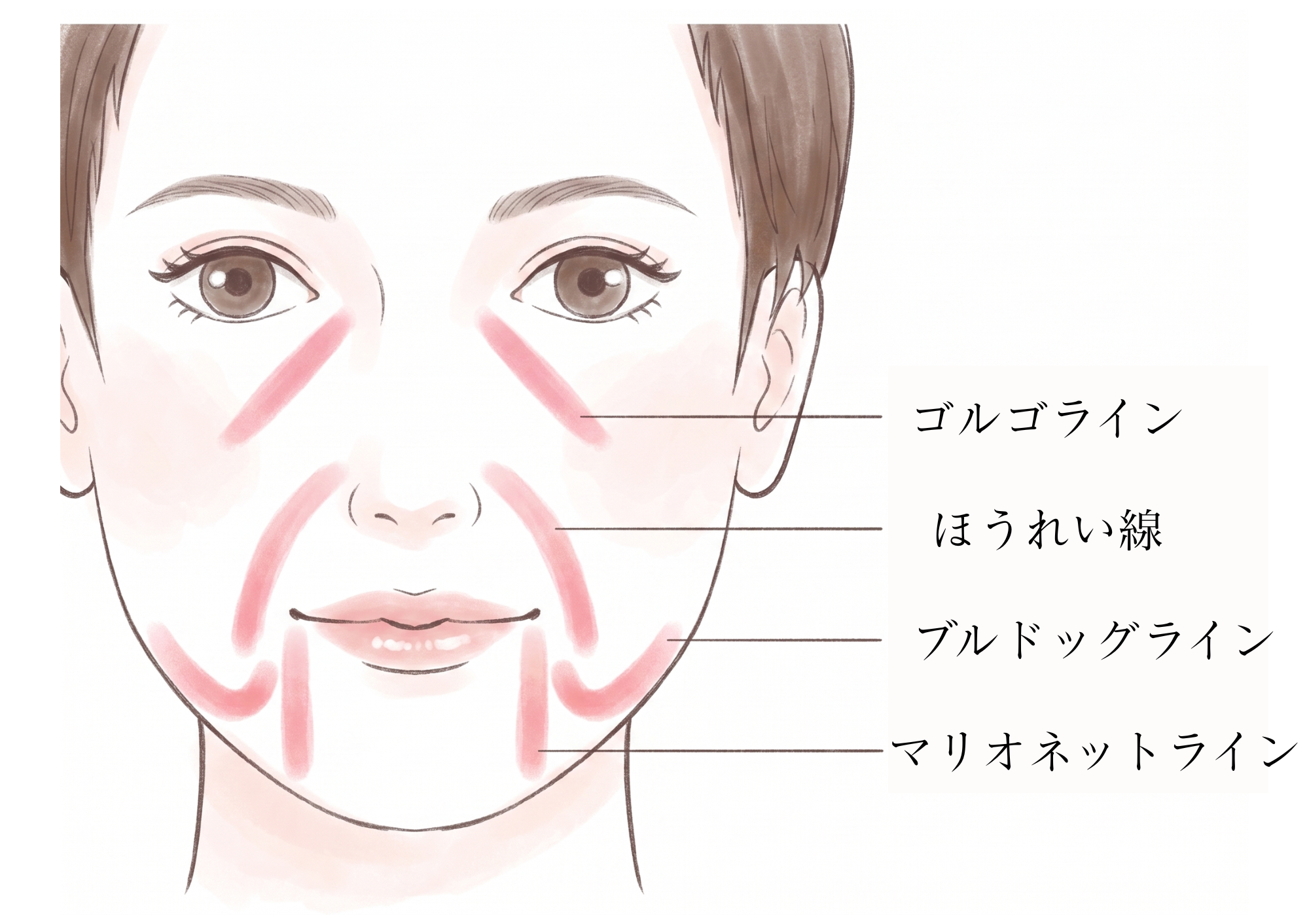 ほうれい線、ゴルゴライン