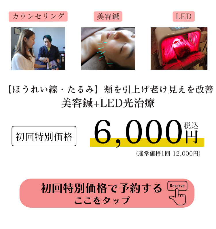 たるみ・ほうれい線改善の美容鍼+LED初回オファー