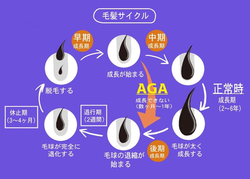 AGA(男性型薄毛)の毛髪サイクル